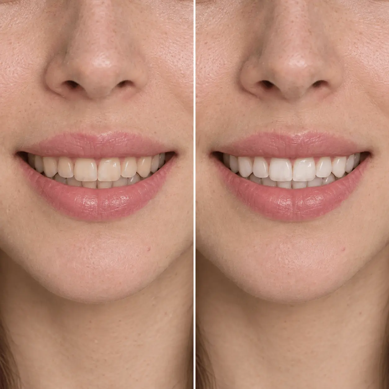 Clarear dentes